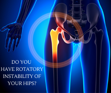 Do you have rotatory instability of your hips