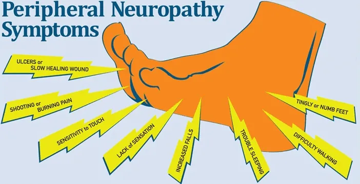 Peripheral Neuropathy Syptoms